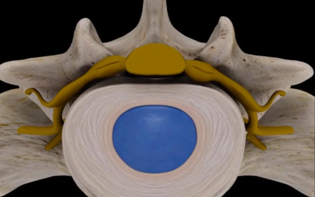 Varför har vi ont i ryggen?