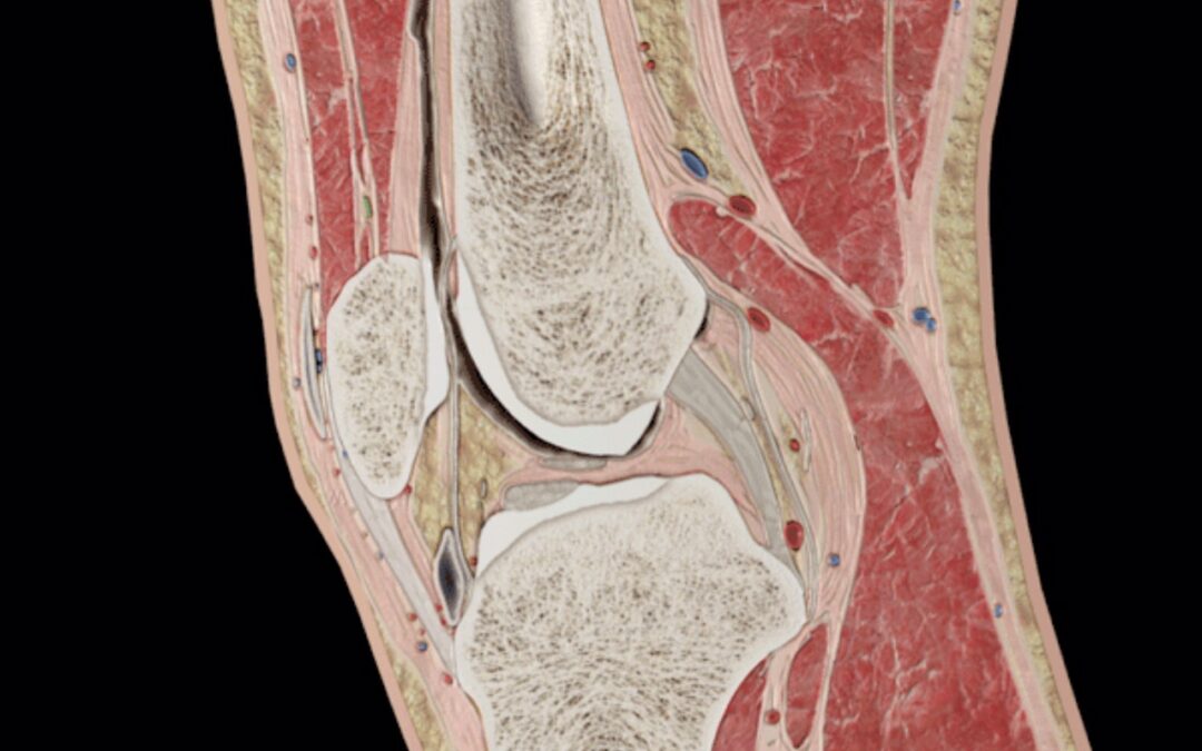 Störningar i patellofemoralleden